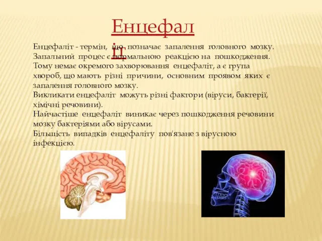 Енцефаліт Енцефаліт - термін, що позначає запалення головного мозку. Запальний