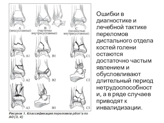 Ошибки в диагностике и лечебной тактике переломов дистального отдела костей голени остаются достаточно