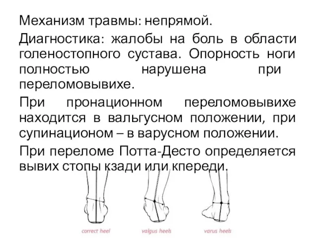 Механизм травмы: непрямой. Диагностика: жалобы на боль в области голеностопного сустава. Опорность ноги
