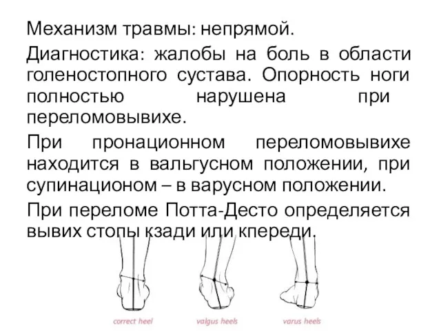 Механизм травмы: непрямой. Диагностика: жалобы на боль в области голеностопного