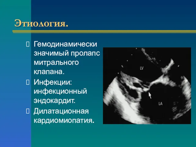 Этиология. Гемодинамически значимый пролапс митрального клапана. Инфекции: инфекционный эндокардит. Дилатационная кардиомиопатия.