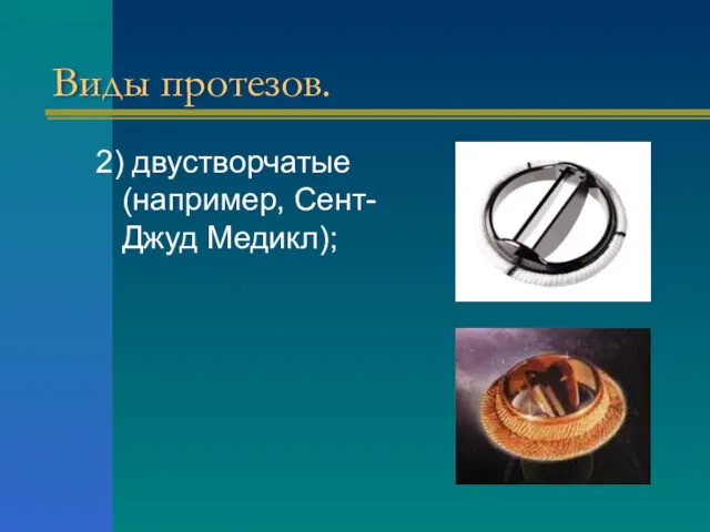 Виды протезов. 2) двустворчатые (например, Сент-Джуд Медикл);