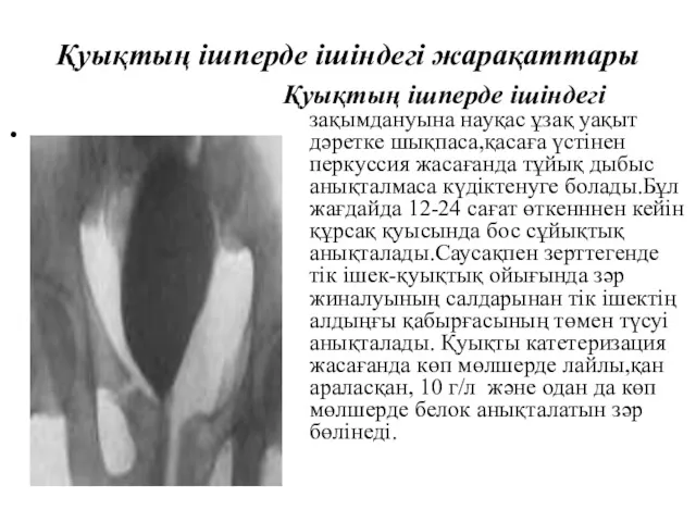 Қуықтың ішперде ішіндегі жарақаттары Қуықтың ішперде ішіндегі зақымдануына науқас ұзақ