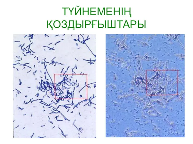 ТҮЙНЕМЕНІҢ ҚОЗДЫРҒЫШТАРЫ