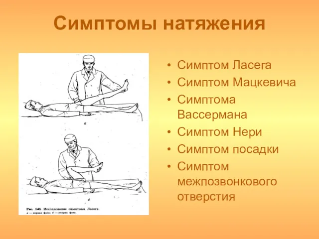 Симптомы натяжения Симптом Ласега Симптом Мацкевича Симптома Вассермана Симптом Нери Симптом посадки Симптом межпозвонкового отверстия