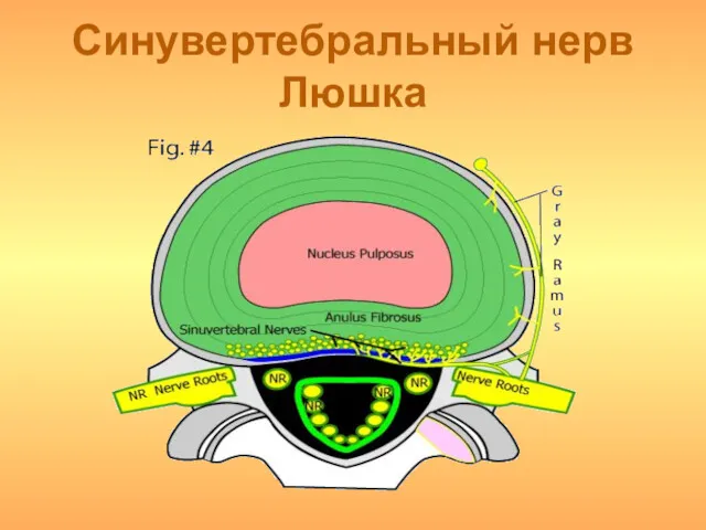 Синувертебральный нерв Люшка