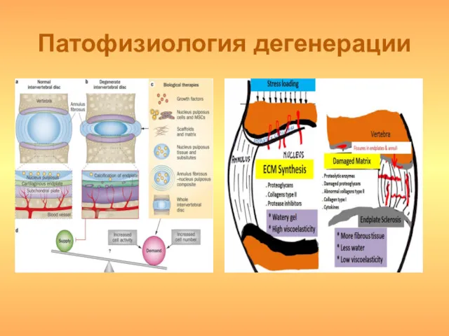 Патофизиология дегенерации