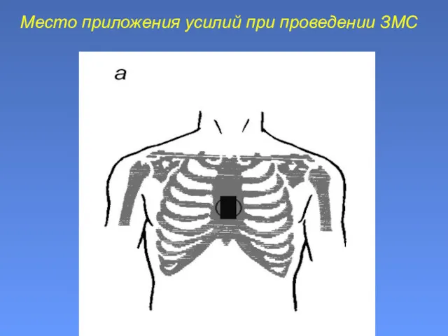 Место приложения усилий при проведении ЗМС