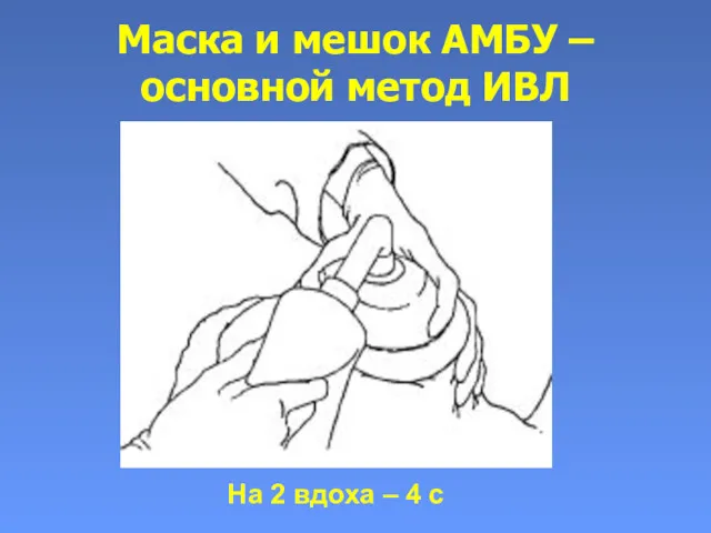 Маска и мешок АМБУ – основной метод ИВЛ На 2 вдоха – 4 с