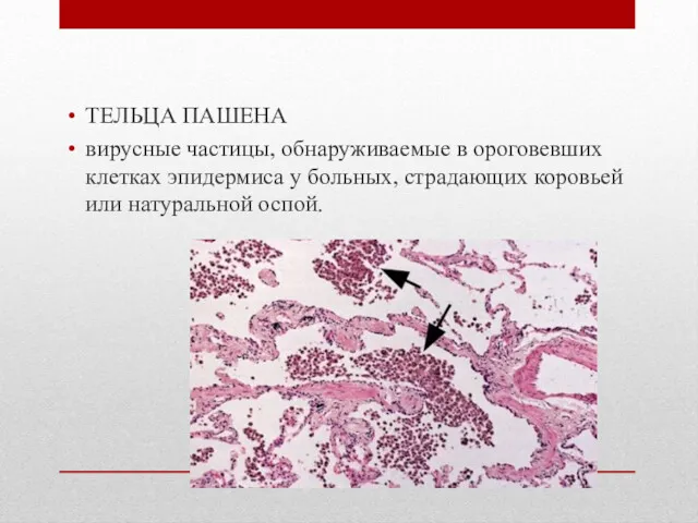 ТЕЛЬЦА ПАШЕНА вирусные частицы, обнаруживаемые в ороговевших клетках эпидермиса у больных, страдающих коровьей или натуральной оспой.