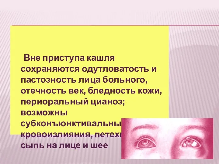 Вне приступа кашля сохраняются одутловатость и пастозность лица больного, отечность