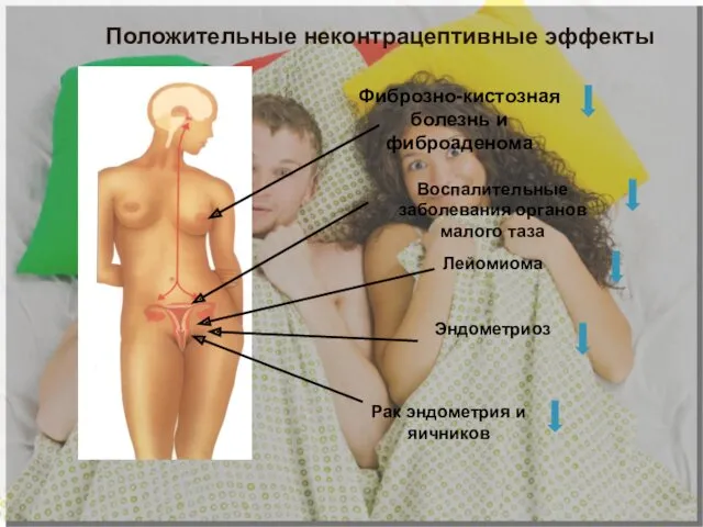 Фиброзно-кистозная болезнь и фиброаденома Воспалительные заболевания органов малого таза Лейомиома