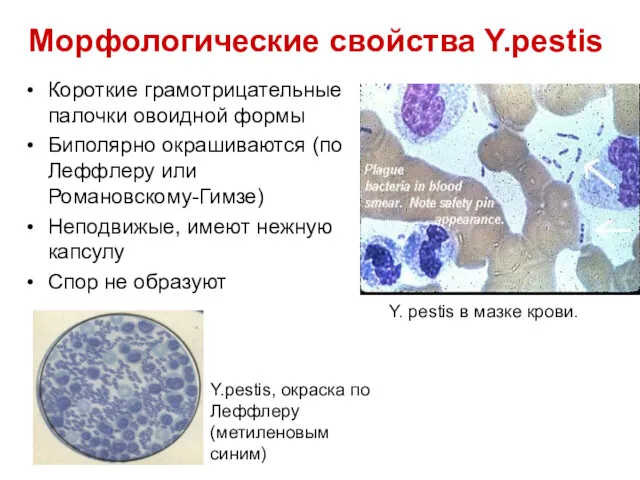 Морфологические свойства Y.pestis Короткие грамотрицательные палочки овоидной формы Биполярно окрашиваются