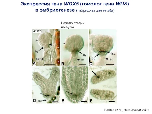 Экспрессия гена WOX5 (гомолог гена WUS) в эмбриогенезе (гибридизация in situ) Haeker et