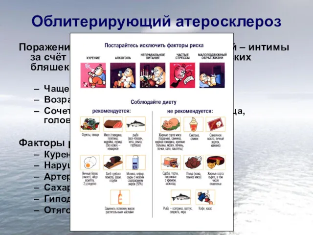 Облитерирующий атеросклероз Поражение внутренней оболочки артерий – интимы за счёт