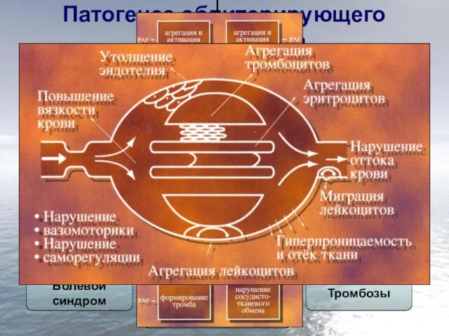 Патогенез облитерирующего атеросклероза