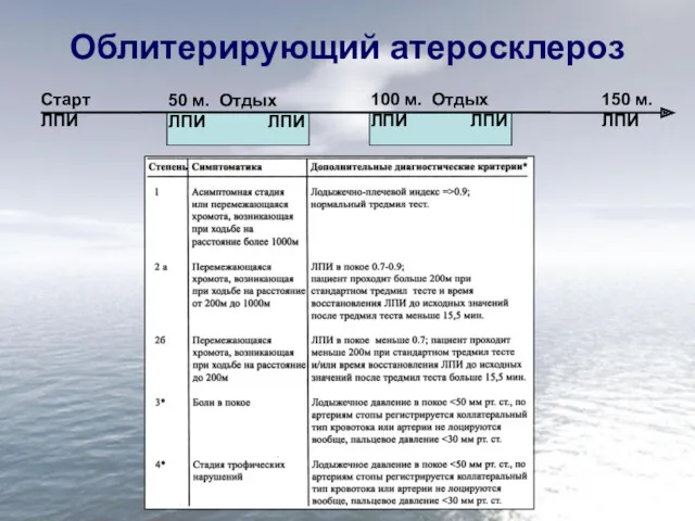 Облитерирующий атеросклероз