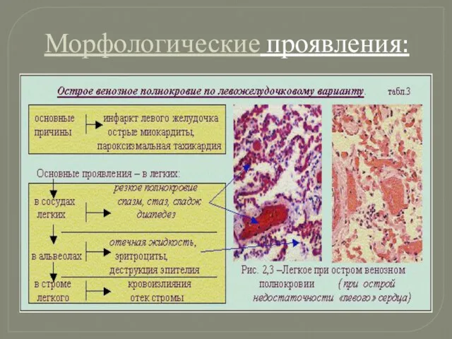 Морфологические проявления: