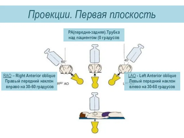 PA(передне-задняя).Трубка над пациентом (0 градусов RAO – Right Anterior oblique