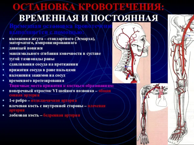 ОСТАНОВКА КРОВОТЕЧЕНИЯ: ВРЕМЕННАЯ И ПОСТОЯННАЯ Временная остановка кровотечения выполняется с