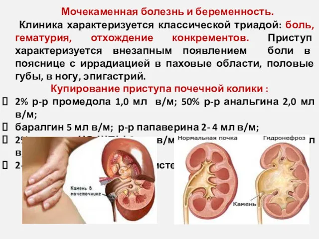 Мочекаменная болезнь и беременность. Клиника характеризуется классической триадой: боль, гематурия,