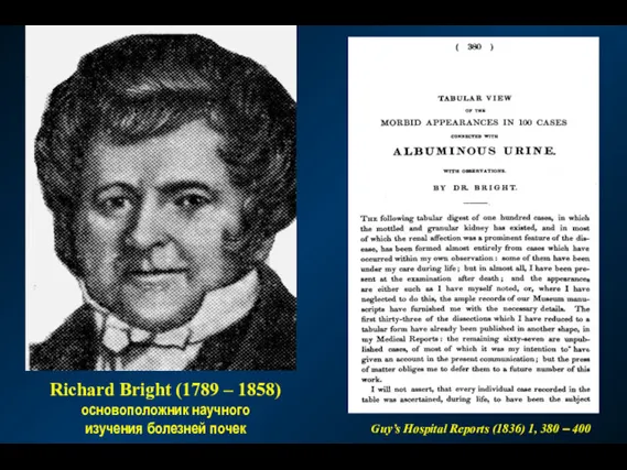 Guy’s Hospital Reports (1836) 1, 380 – 400 Richard Bright