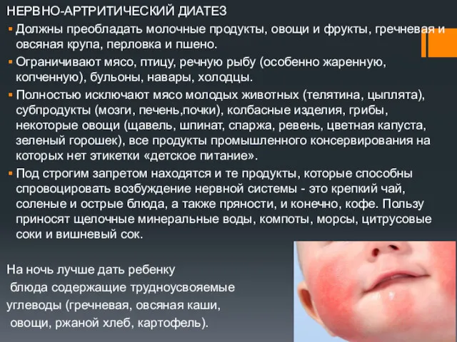 НЕРВНО-АРТРИТИЧЕСКИЙ ДИАТЕЗ Должны преобладать молочные продукты, овощи и фрукты, гречневая и овсяная крупа,