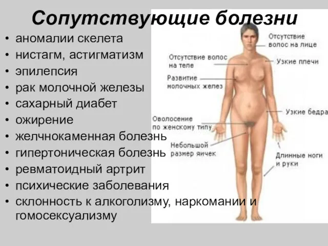 Сопутствующие болезни аномалии скелета нистагм, астигматизм эпилепсия рак молочной железы сахарный диабет ожирение