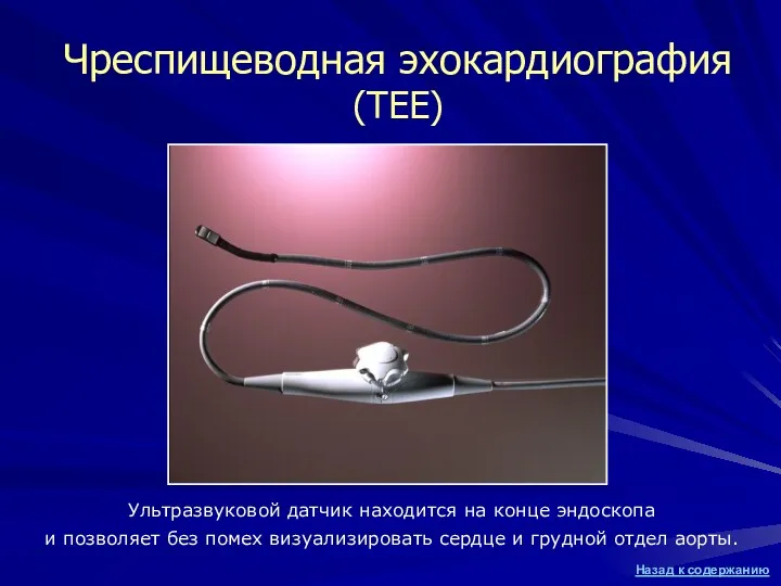 Чреспищеводная эхокардиография (TEE) Ультразвуковой датчик находится на конце эндоскопа и позволяет без помех