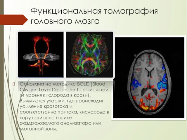 Функциональная томография головного мозга Основана на методике BOLD (Blood Oxygen