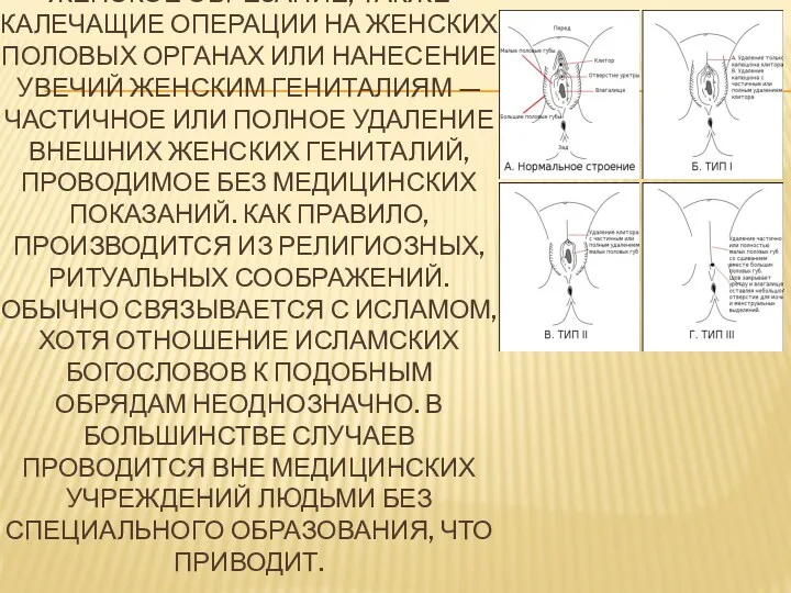 ЖЕ́НСКОЕ ОБРЕЗА́НИЕ, ТАКЖЕ КАЛЕЧАЩИЕ ОПЕРАЦИИ НА ЖЕНСКИХ ПОЛОВЫХ ОРГАНАХ ИЛИ