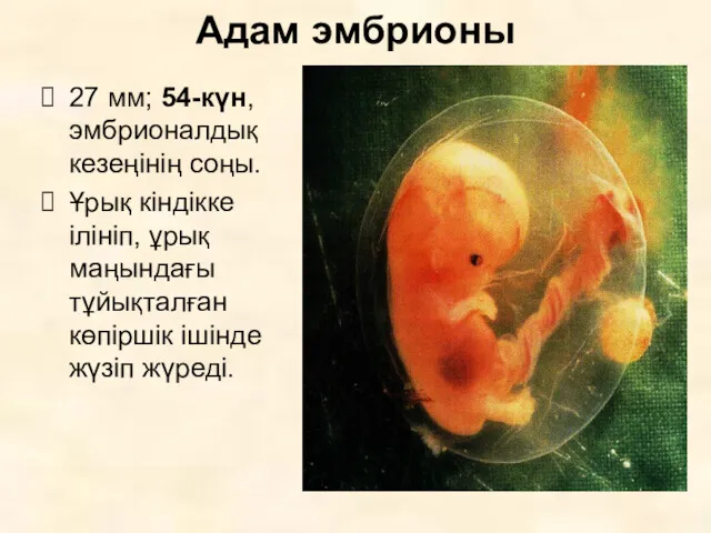 Адам эмбрионы 27 мм; 54-күн, эмбрионалдық кезеңінің соңы. Ұрық кіндікке