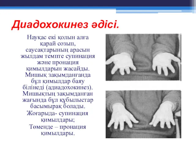 Диадохокинез әдісі. Науқас екі қолын алға қарай созып, саусақтарының арасын