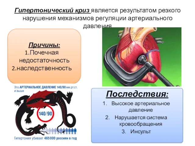 Гипертонический криз является результатом резкого нарушения механизмов регуляции артериального давления