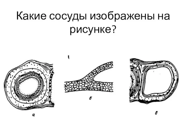 Какие сосуды изображены на рисунке?