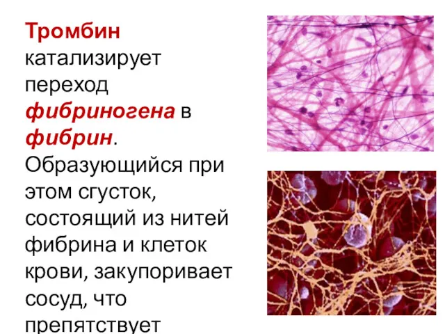 Тромбин катализирует переход фибриногена в фибрин. Образующийся при этом сгусток,