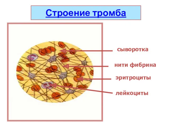 Строение тромба нити фибрина эритроциты лейкоциты сыворотка