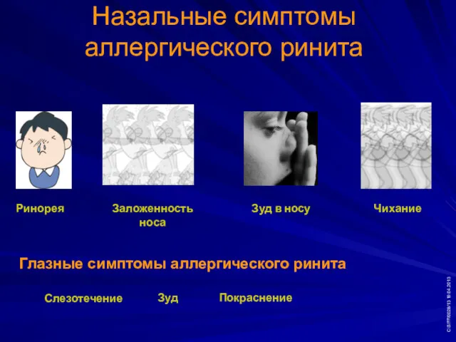 Ринорея Заложенность носа Зуд в носу Чихание Назальные симптомы аллергического ринита CIS/FF/0028/13 19.04.2013