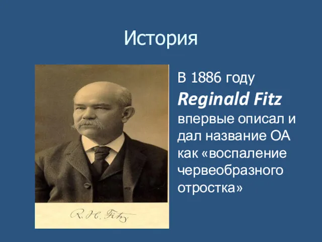 История В 1886 году Reginald Fitz впервые описал и дал название ОА как «воспаление червеобразного отростка»