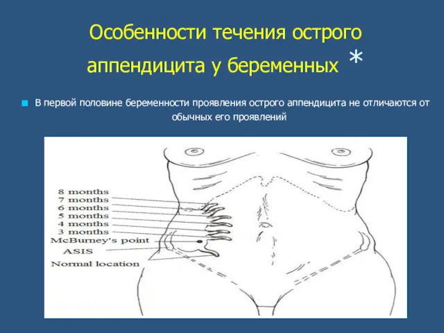 Особенности течения острого аппендицита у беременных * В первой половине