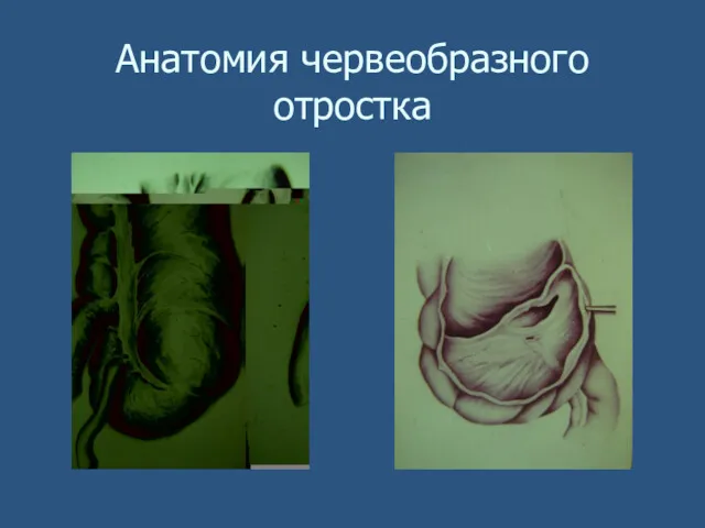 Анатомия червеобразного отростка