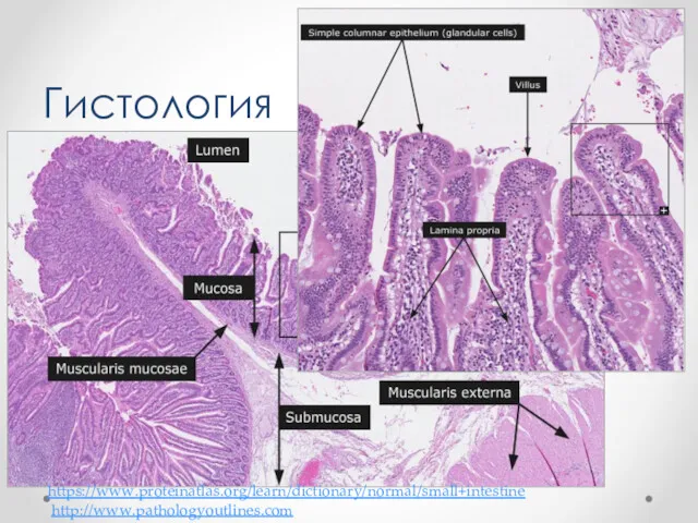 Гистология https://www.proteinatlas.org/learn/dictionary/normal/small+intestine http://www.pathologyoutlines.com