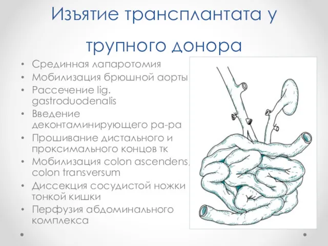 Изъятие трансплантата у трупного донора Срединная лапаротомия Мобилизация брюшной аорты