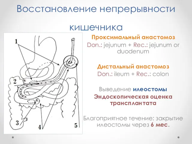 Восстановление непрерывности кишечника Проксимальный анастомоз Don.: jejunum + Rec.: jejunum