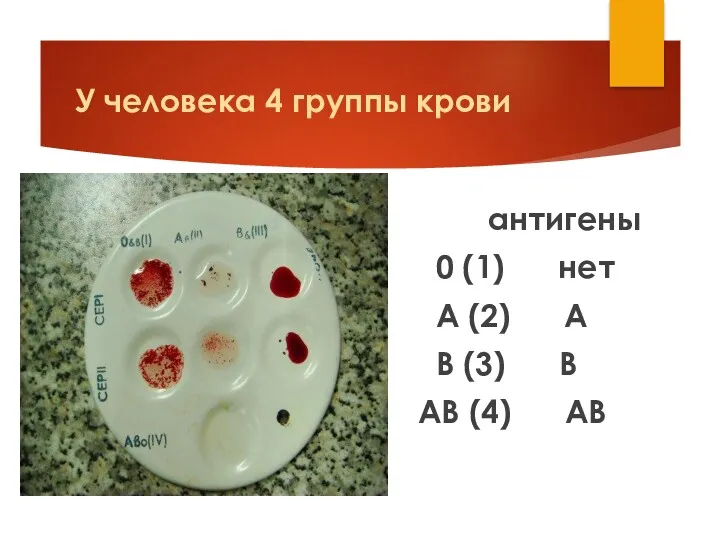 У человека 4 группы крови антигены 0 (1) нет А