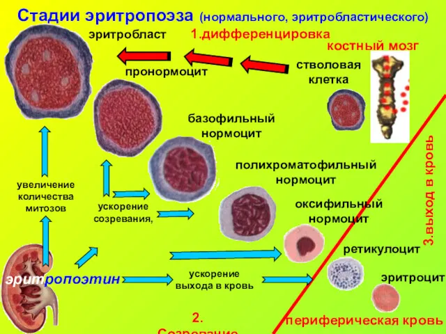 Стадии эритропоэза (нормального, эритробластического) костный мозг периферическая кровь 3.выход в кровь 1.дифференцировка 2.Созревание