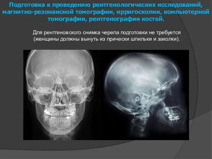 Подготовка к проведению рентгенологических исследований, магнитно-резонансной томографии, ирригоскопии, компьютерной томографии, рентгенографии костей. Для