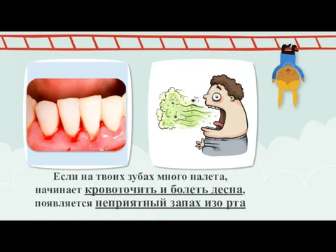 Если на твоих зубах много налета, начинает кровоточить и болеть десна, появляется неприятный запах изо рта