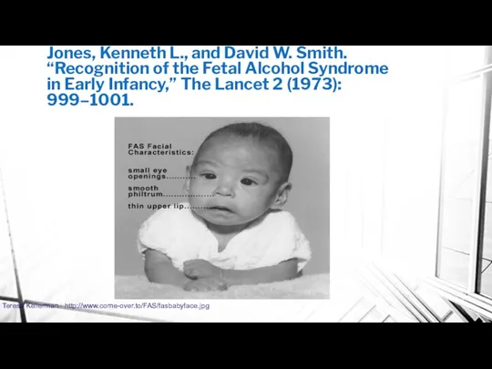 Jones, Kenneth L., and David W. Smith. “Recognition of the Fetal Alcohol Syndrome