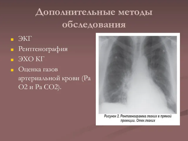 Дополнительные методы обследования ЭКГ Рентгенография ЭХО КГ Оценка газов артериальной крови (Ра О2 и Ра СО2).
